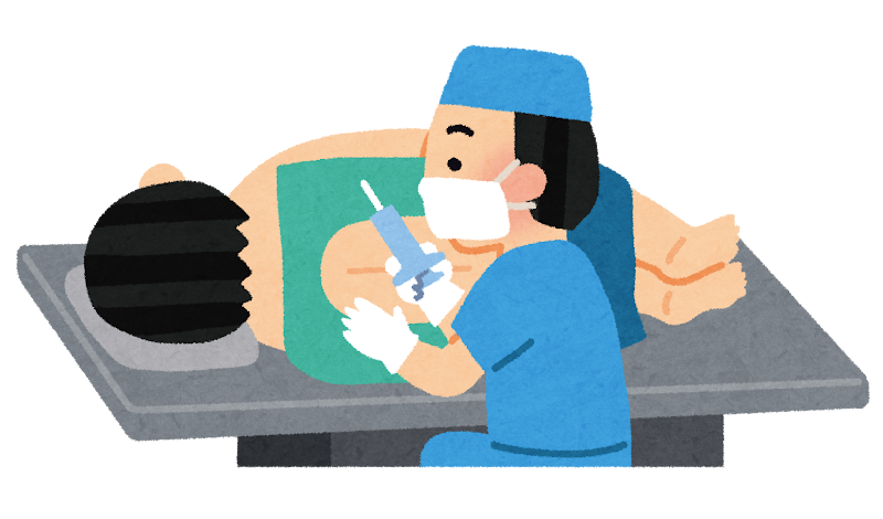  硬膜外ブロックとは